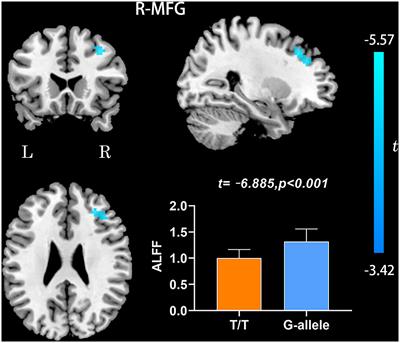 The Effects of rs405509 on APOEε4 Non-carriers in Non-demented Aging